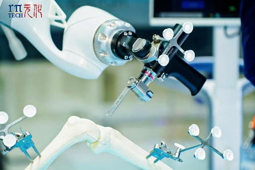 科技賦能醫(yī)療新未來(lái) 元化智能錕铻全骨科手術(shù)機(jī)器人閃耀進(jìn)博會(huì)